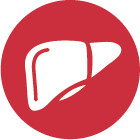 Cirrhosis